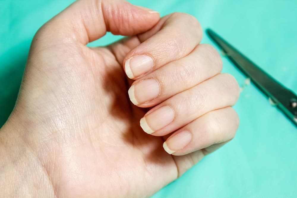 How To Fix Uneven Nails at Barb Albrecht blog