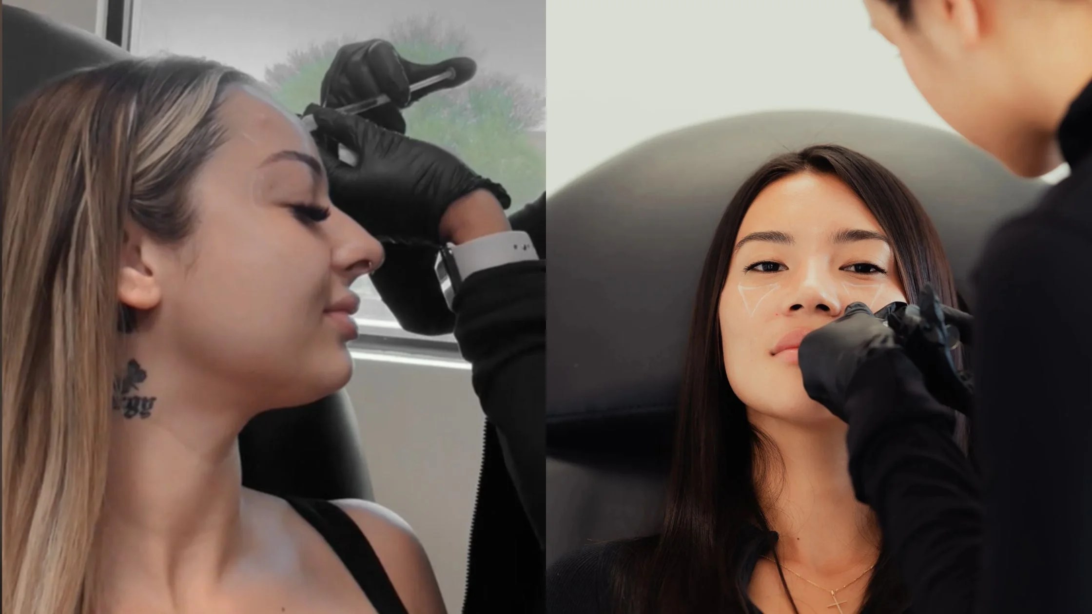 Botox & Filler in Chino Hills | Natural, Long-Lasting Results – NAKEDMD