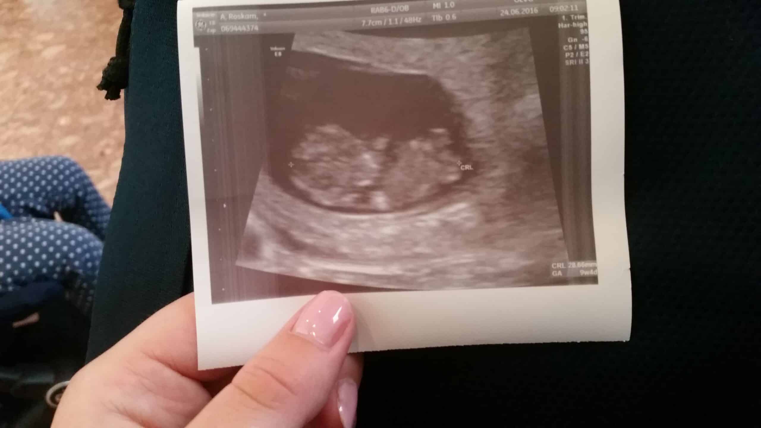 Zwangerschap 3 maanden zwanger Nanny Annelon