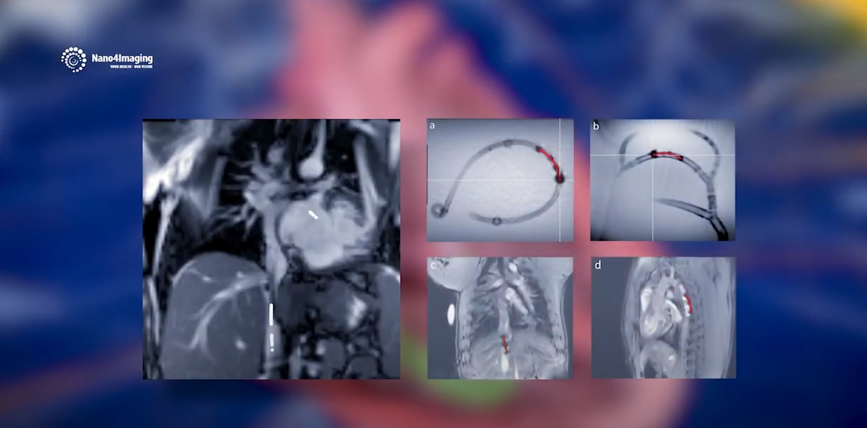 Our vision on MRI supported markers Nano4Imaging