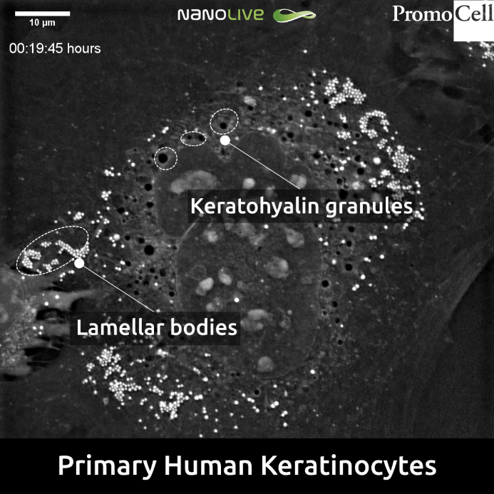 Lamellar Bodies and Keratohyalin Granules in Normal Human Epidermal