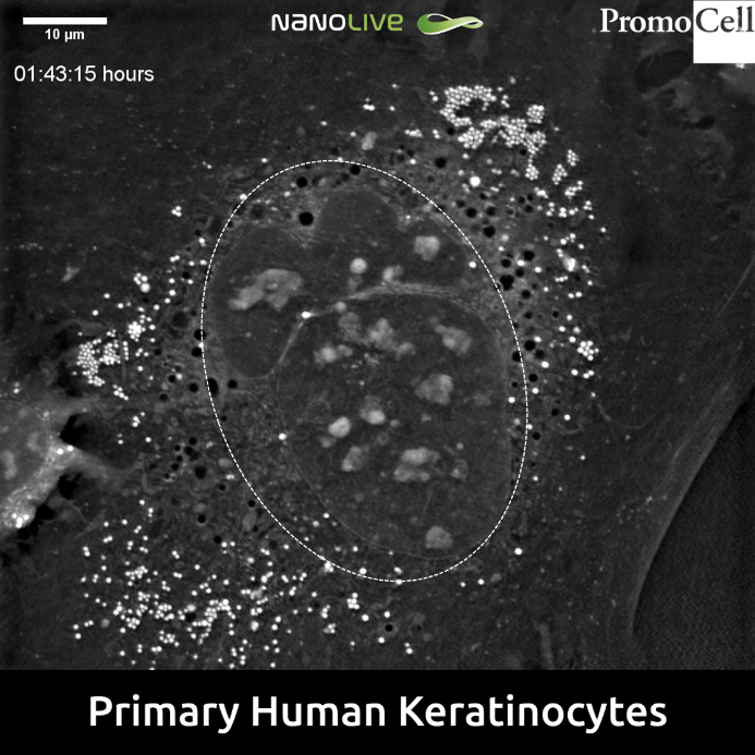 Lamellar Bodies and Keratohyalin Granules in Normal Human Epidermal