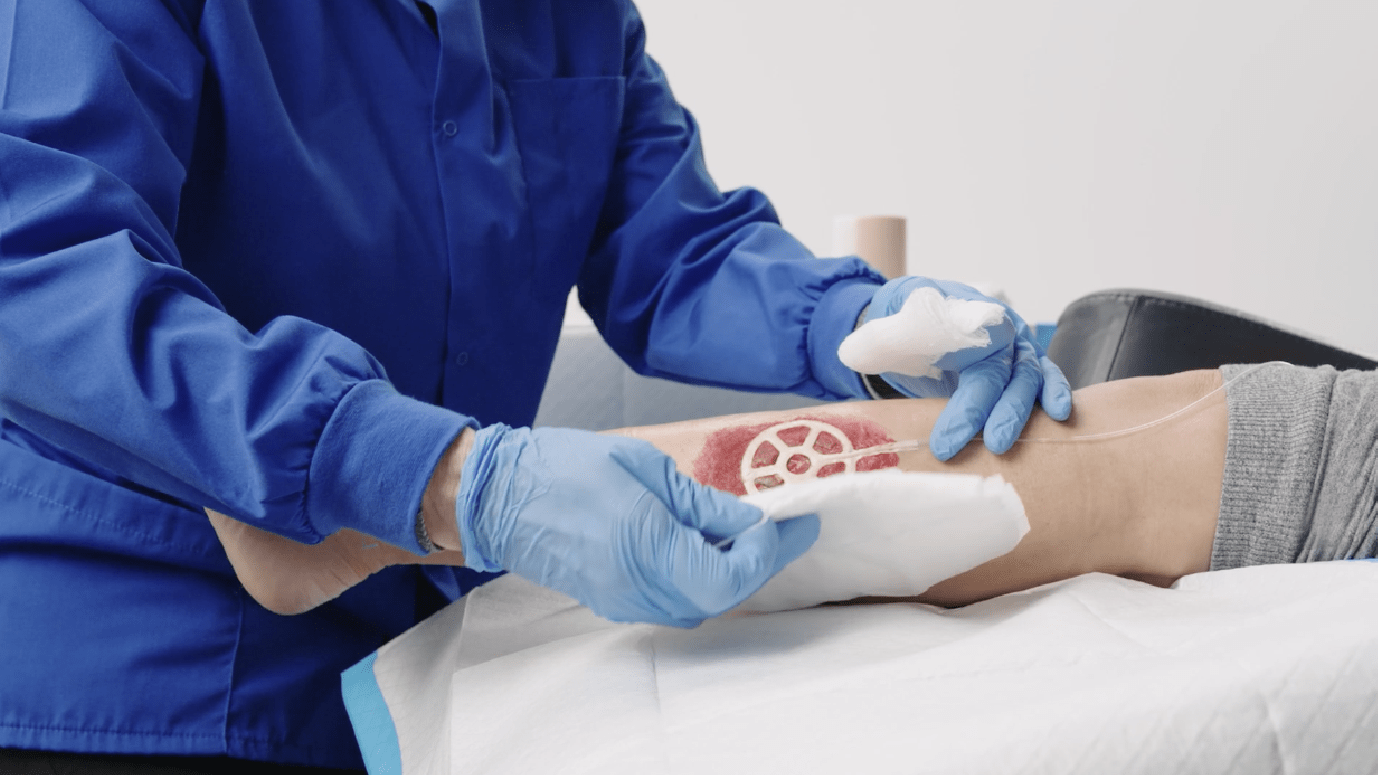 NATROX® Topical Oxygen Therapy Application Videos