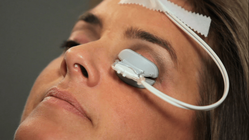 FDA AyeAye to 2nd TearScience DryEye Tool North