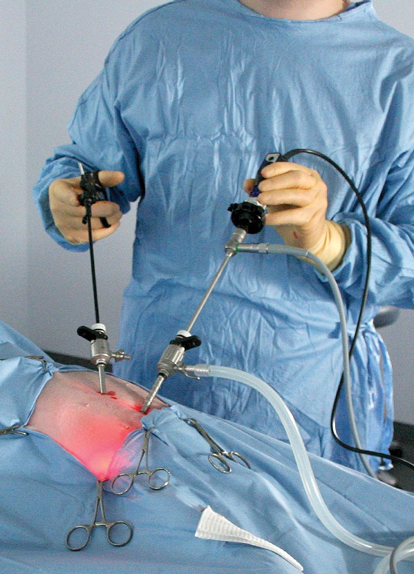 Laparoscopic ovariectomy (Keyhole spay) NDSR