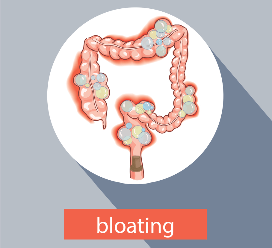 Bloating /Belching