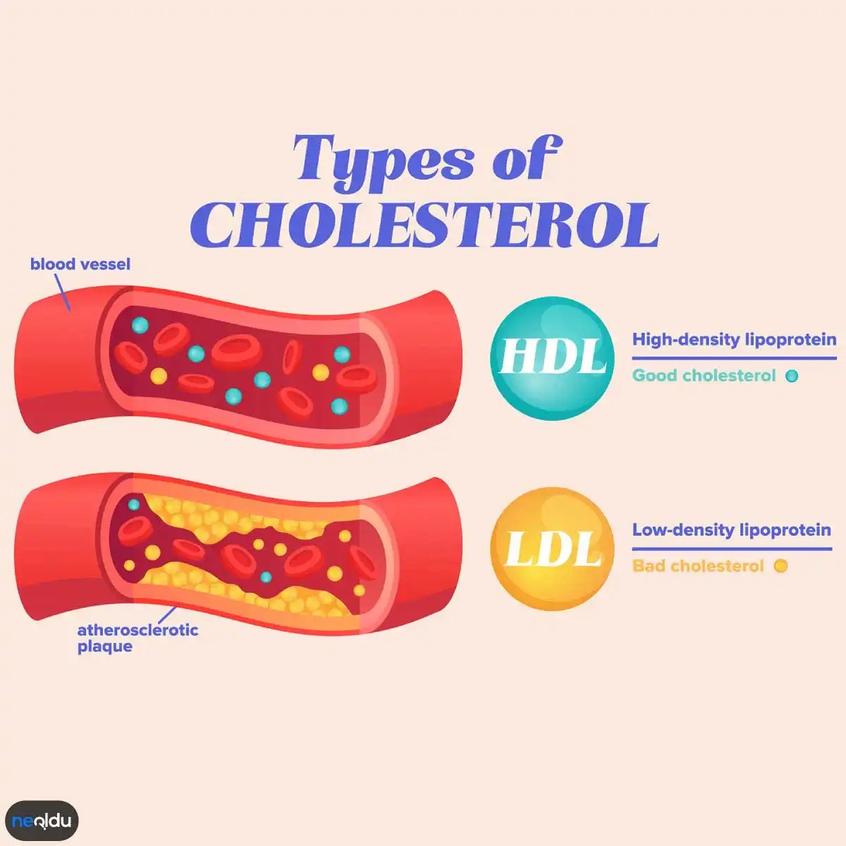 Kolesterol Nedir? Yüksek Kolesterol Belirtileri ve Tedavisi