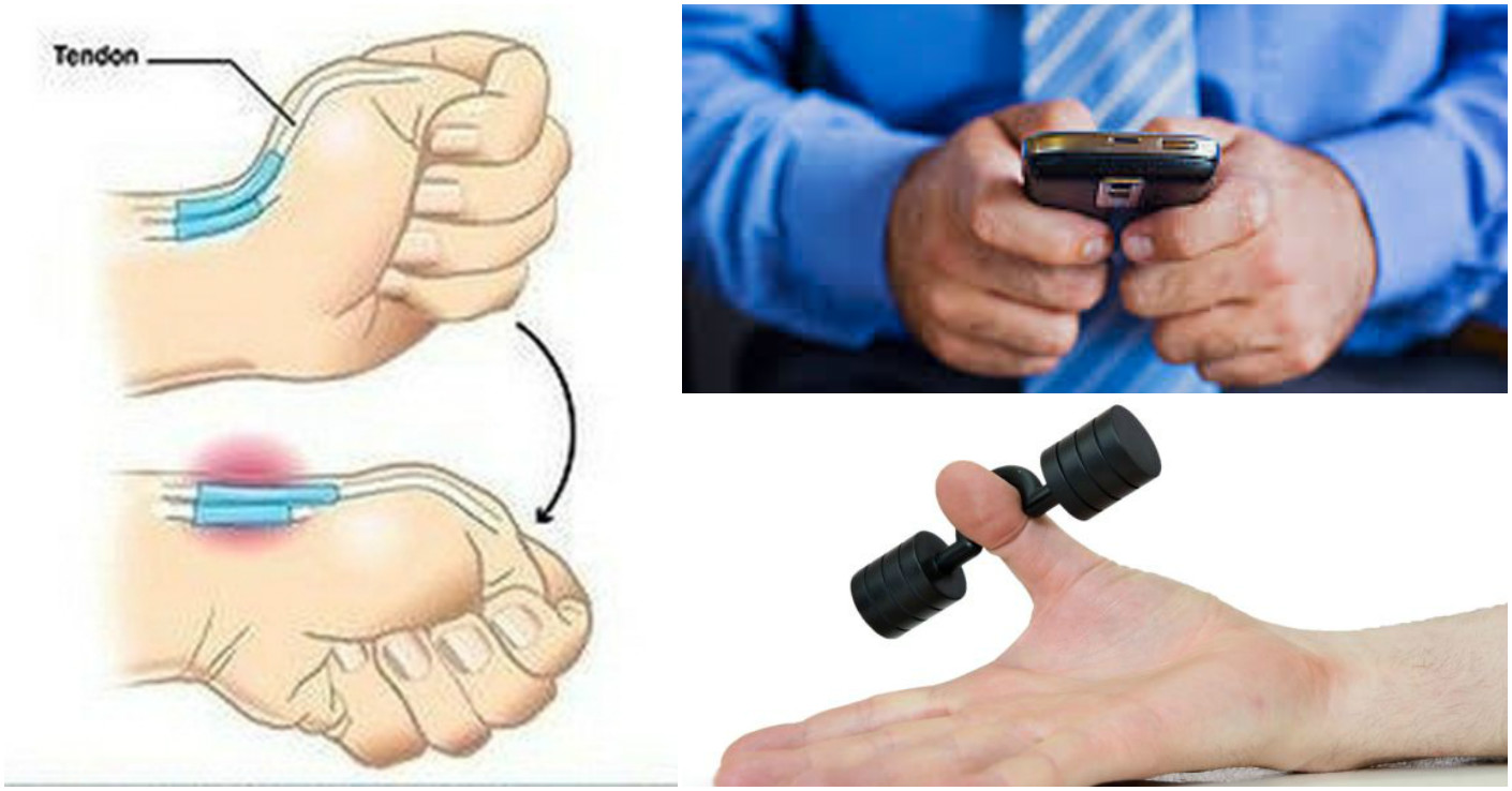 Ever heard about a disease called 'smartphone thumb'? Too much texting