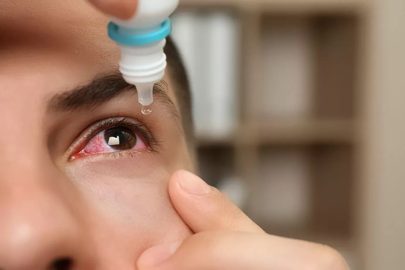 Eye Drops Recalled in California after CDC Health Alert
