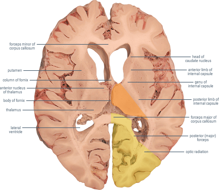 Posterior Cerebral Artery