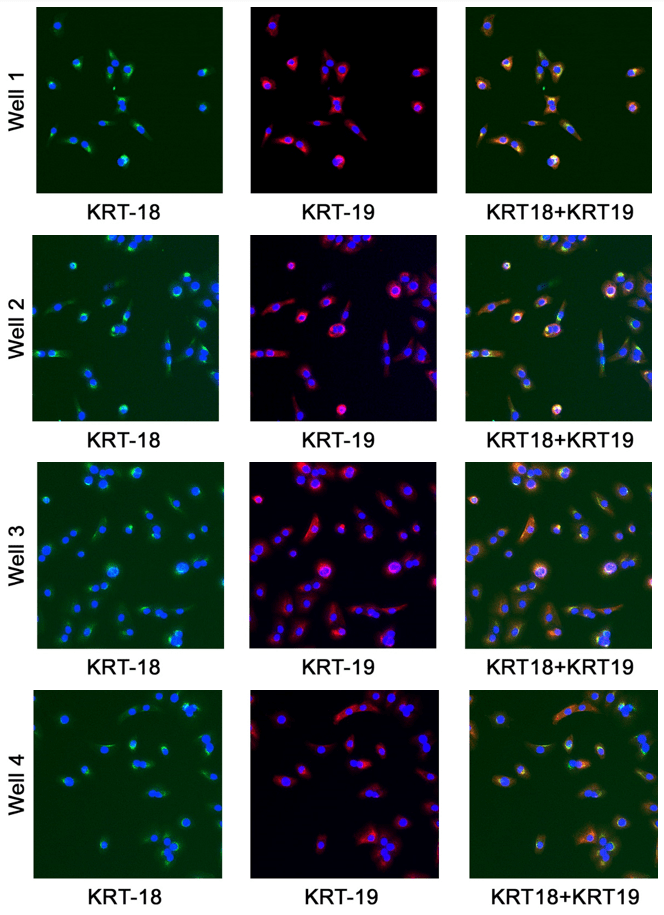 Human Prostate Carcinoma Cells (DU 145)