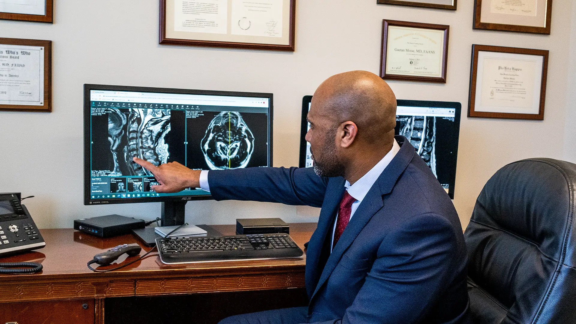 Arnold Chiari Malformation Type 1 Vs. Type 2