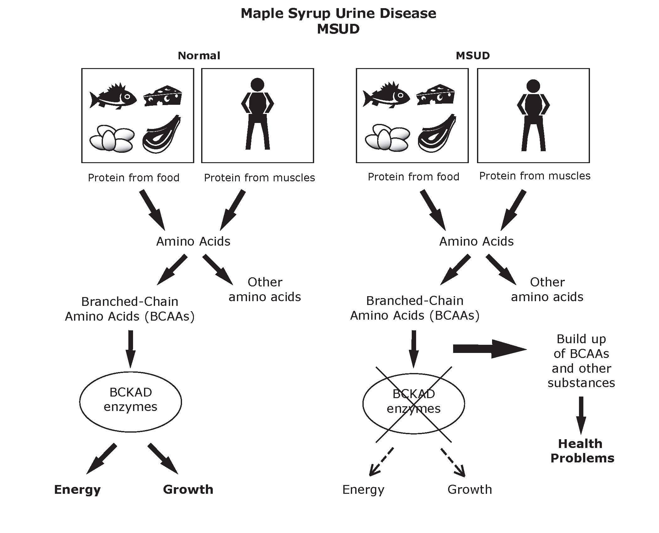 Maple Syrup Urine Disease Eat Know How