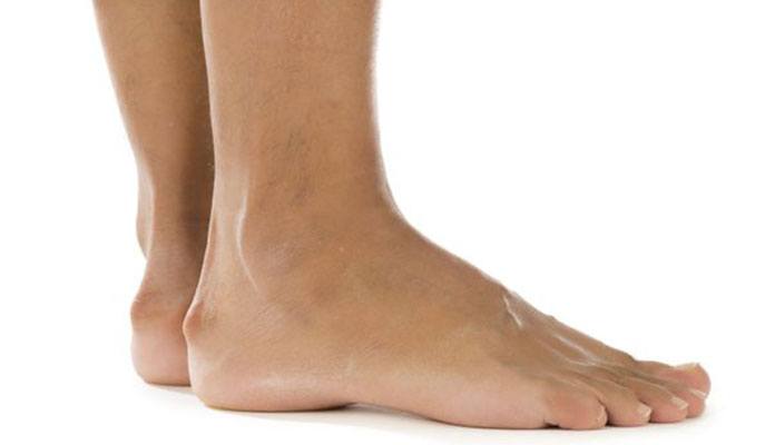 10 Causes of Heel Pain New Life Ticket Part 7