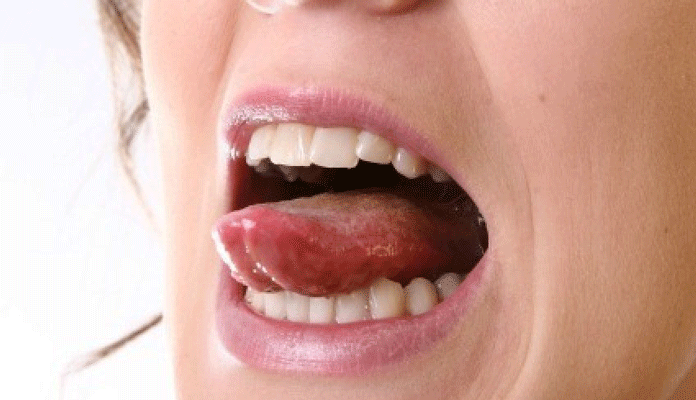 Should I Worry About Bumps on the Tongue New Life Ticket Part 8