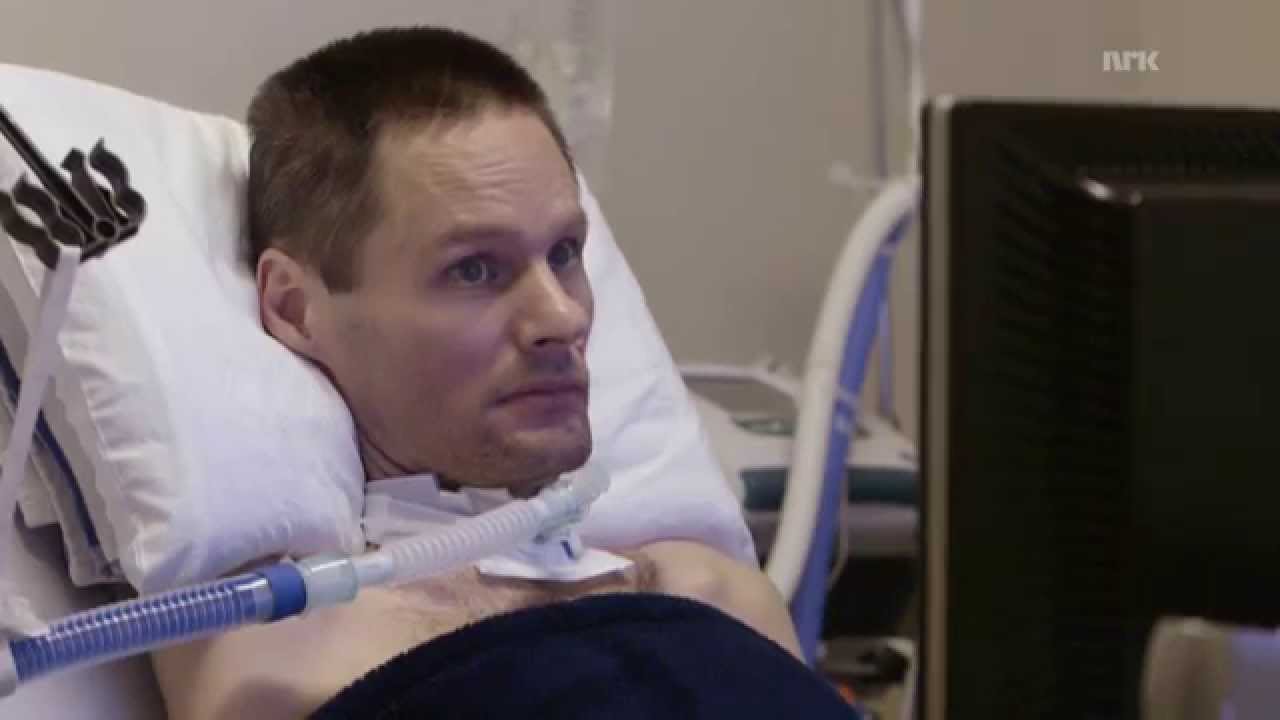 Scientists hope to find Treatment for ALS in Five Years using New Drug