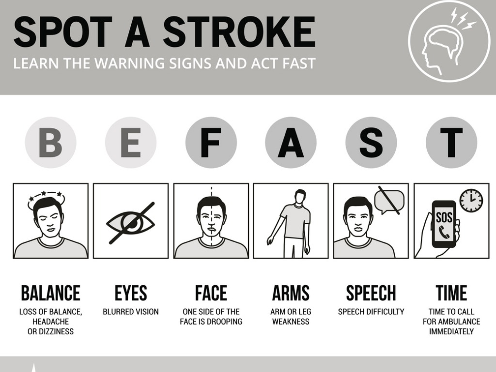 Stroke – Neurological condition Brain Research UK