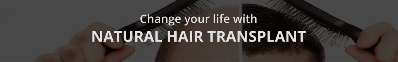 Natural Hair Transplant Results, before after gallery