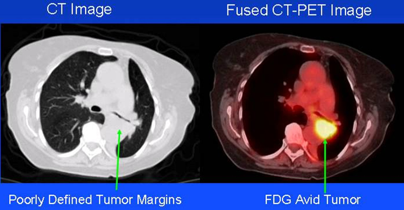 Nuclear Medicine National Institute of Biomedical Imaging and Nuclear Medicine National Institute of Biomedical Imaging and