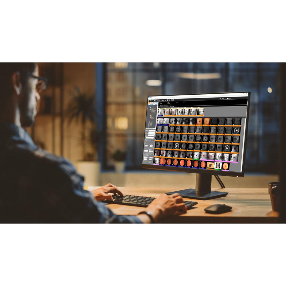 Logiciel NavisEx diagnostic rétine et segment antérieur NIDEK France