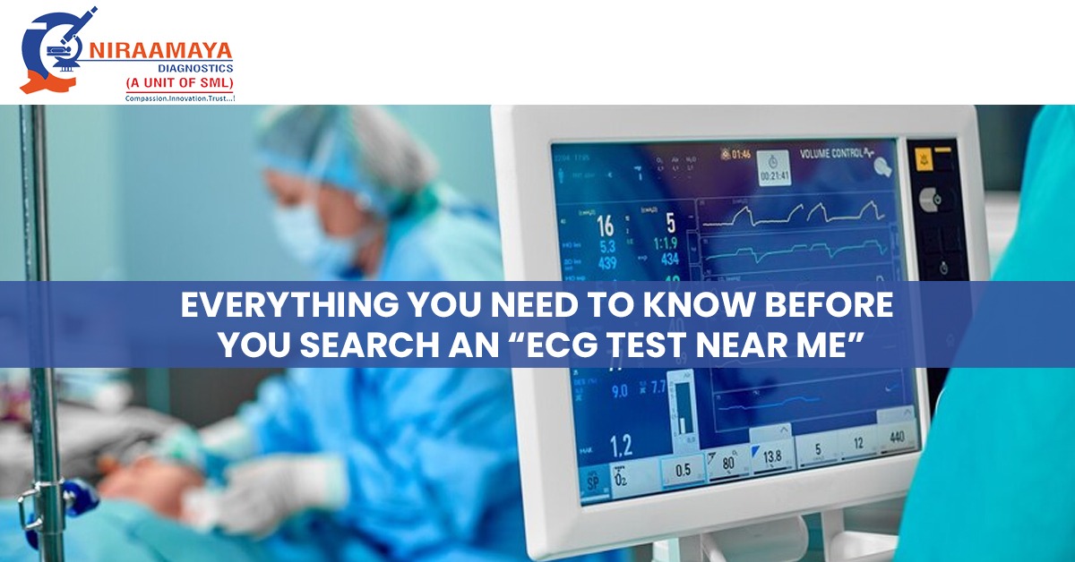 Everything You Need To Know Before You Search an “ECG Test near Me