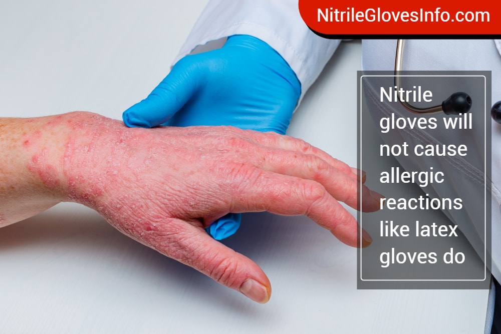 What is the difference between latex and nitrile gloves? Nitrile
