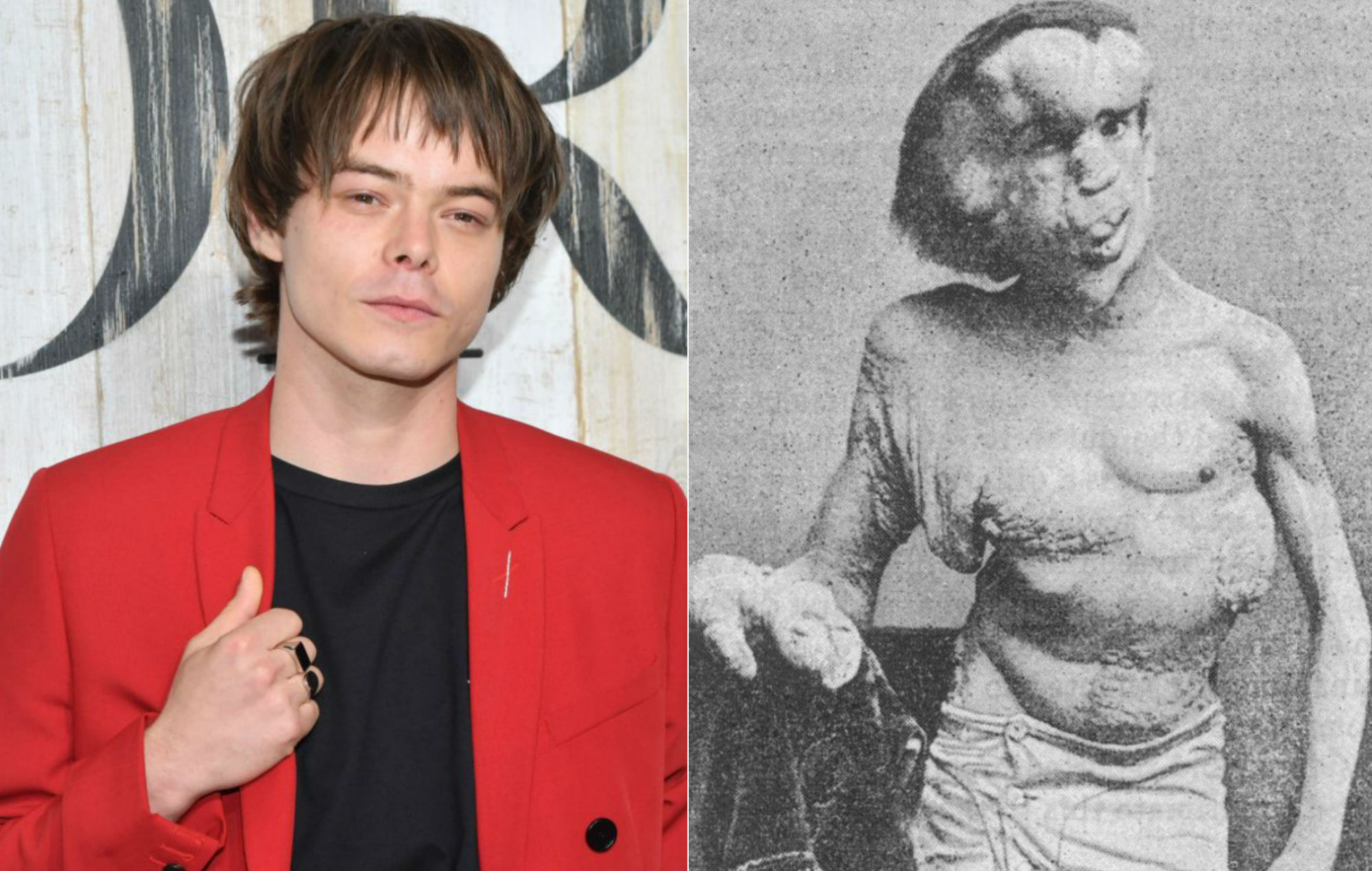 BBC criticised for not casting disabled actor in 'The Elephant Man'