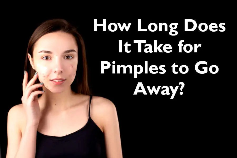 How Long Does It Take for Pimples to Go Away Ultimate Guide