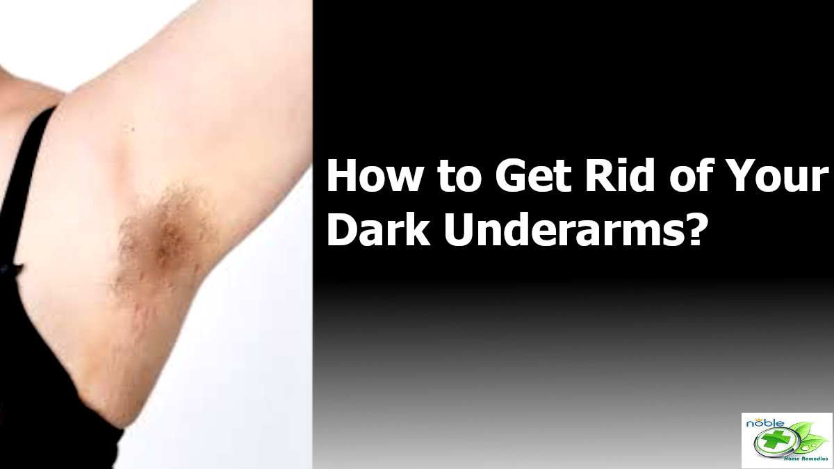 How to Get Rid of Dark Underarms? 15 Natural Remedies