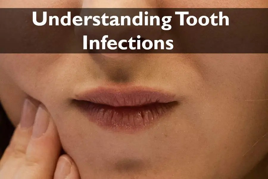 Understanding Tooth Infections Causes, Symptoms & Remedies