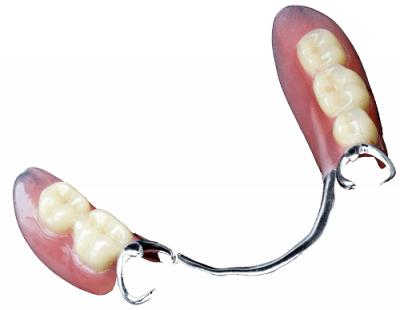 Smile with partial dentures and partial denture repairs by Nolan