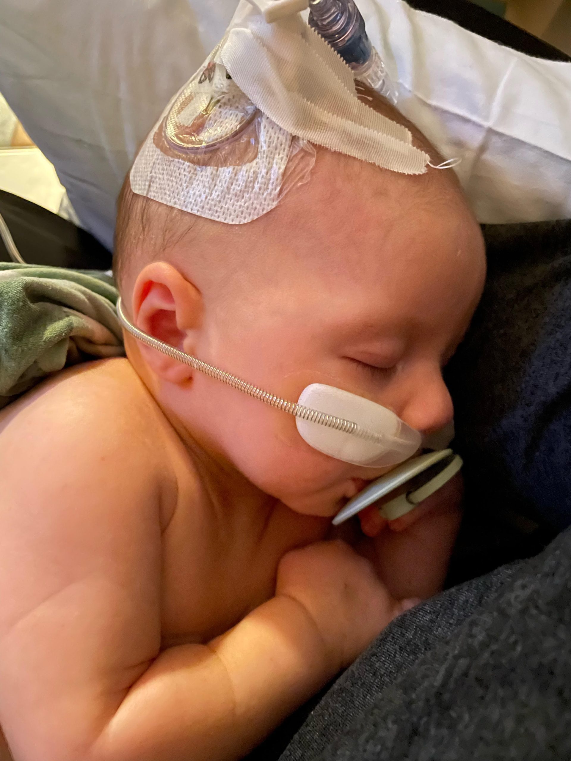 NC hospitals swamped with kids battling respiratory viruses NC Health