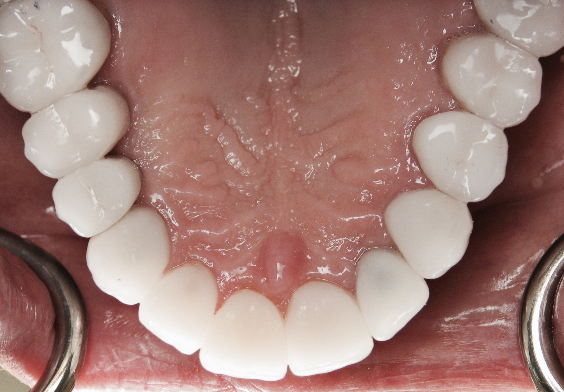 Dental Case Study 38 North Shore Restorative and Implant Dentistry