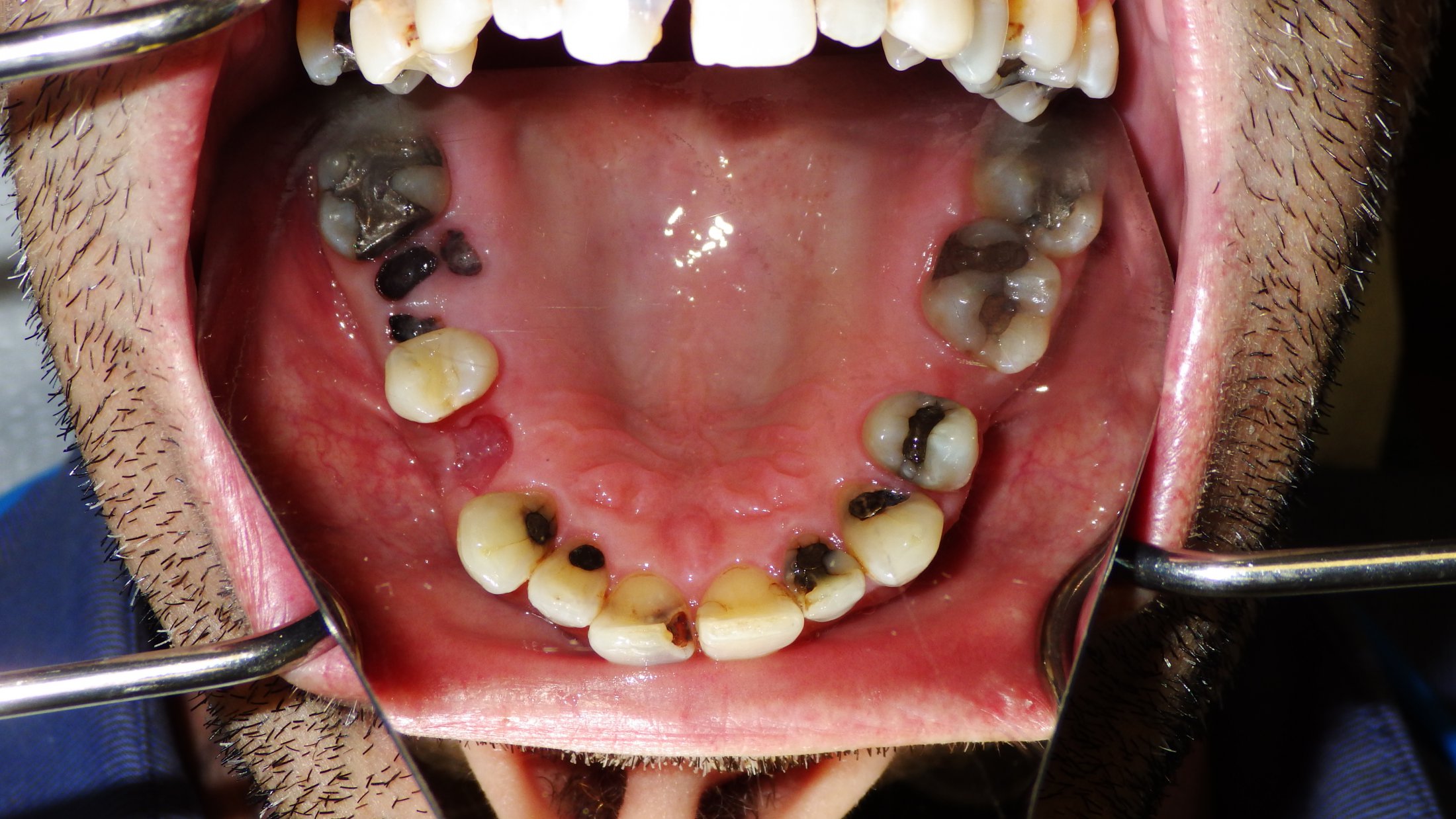 Dental Case Study 37 North Shore Restorative and Implant Dentistry