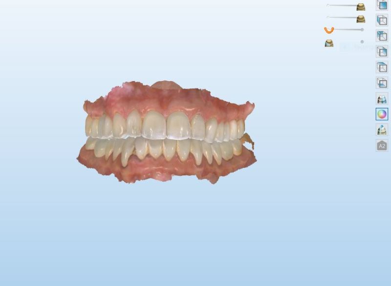 Dental Case Study 42 North Shore Restorative and Implant Dentistry
