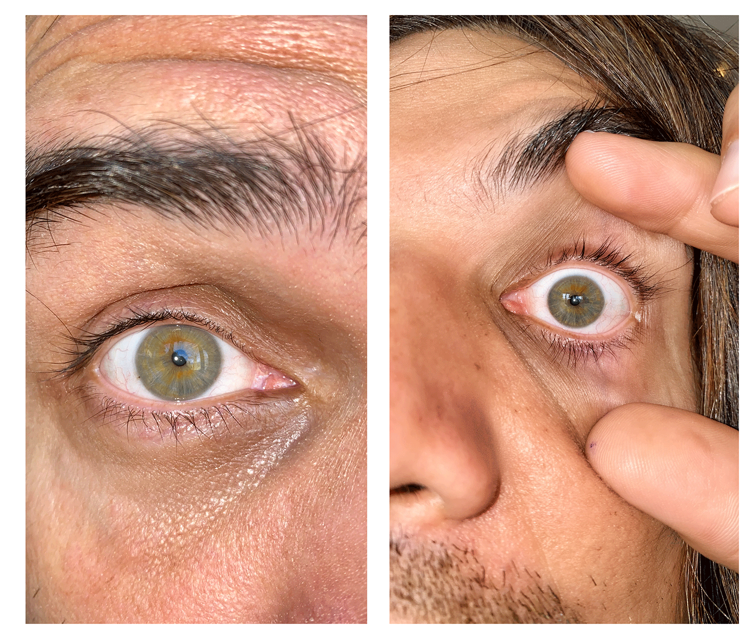 Eye Picture Instructions North Toronto Eyecare