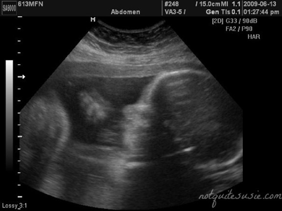 Find Out How Far Along Your Pregnancy Is with the Clearblue Weeks