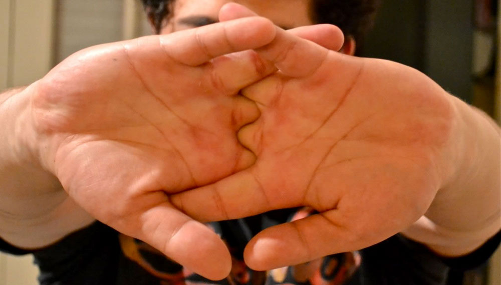 Knuckle Cracking Bad for Bassists? No Treble