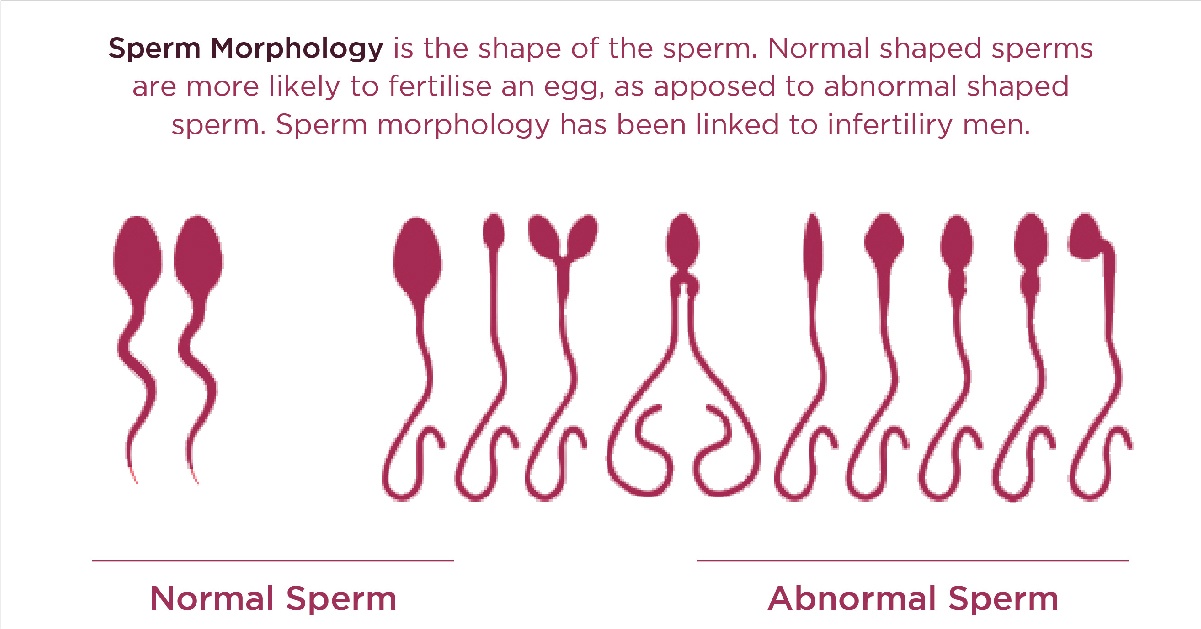 How to Choose a Fertility Clinic? NOVA IVF