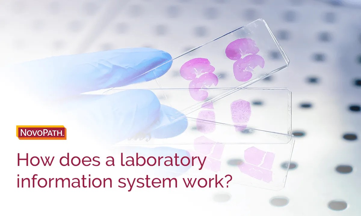 How Does Laboratory Information System (LIS) Software Work? NovoPath