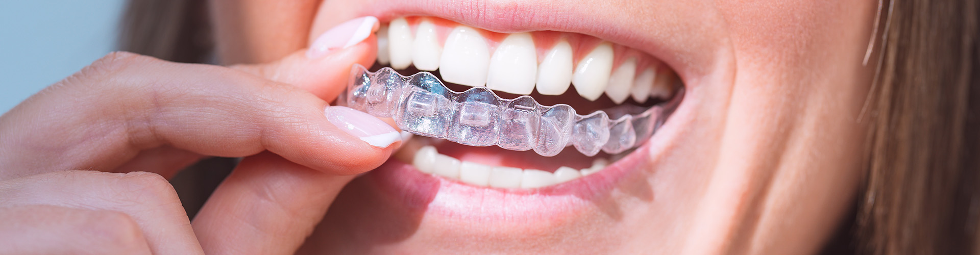 Nu Dentistry Invisalign Straighten Your Teeth with Clear Aligners