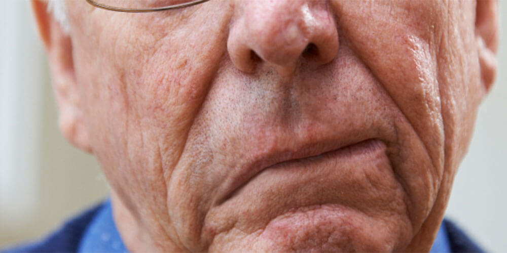 24 timmar före en stroke varnar kroppen dig — dessa dolda varningstecken borde alla känna till