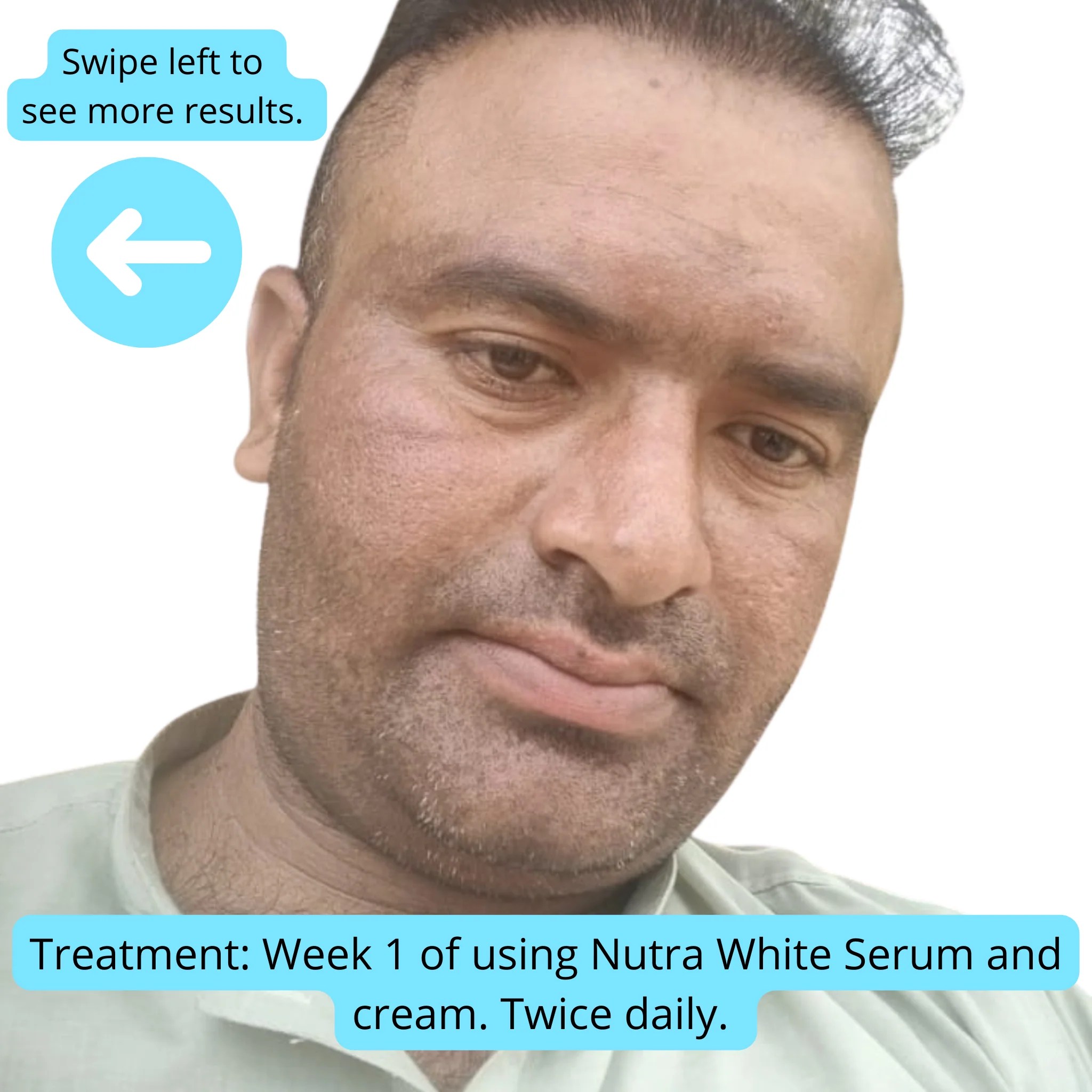 Nutra White Glutathione Whitening Serum Nutrex Labs