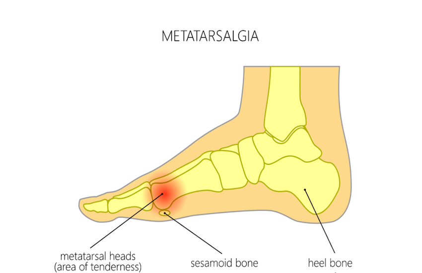 Foot Pain Northwest Foot & Ankle, PS