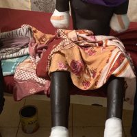 SPLA-IO commander orders subordinate to chop man’s arms over ‘stolen’ phone