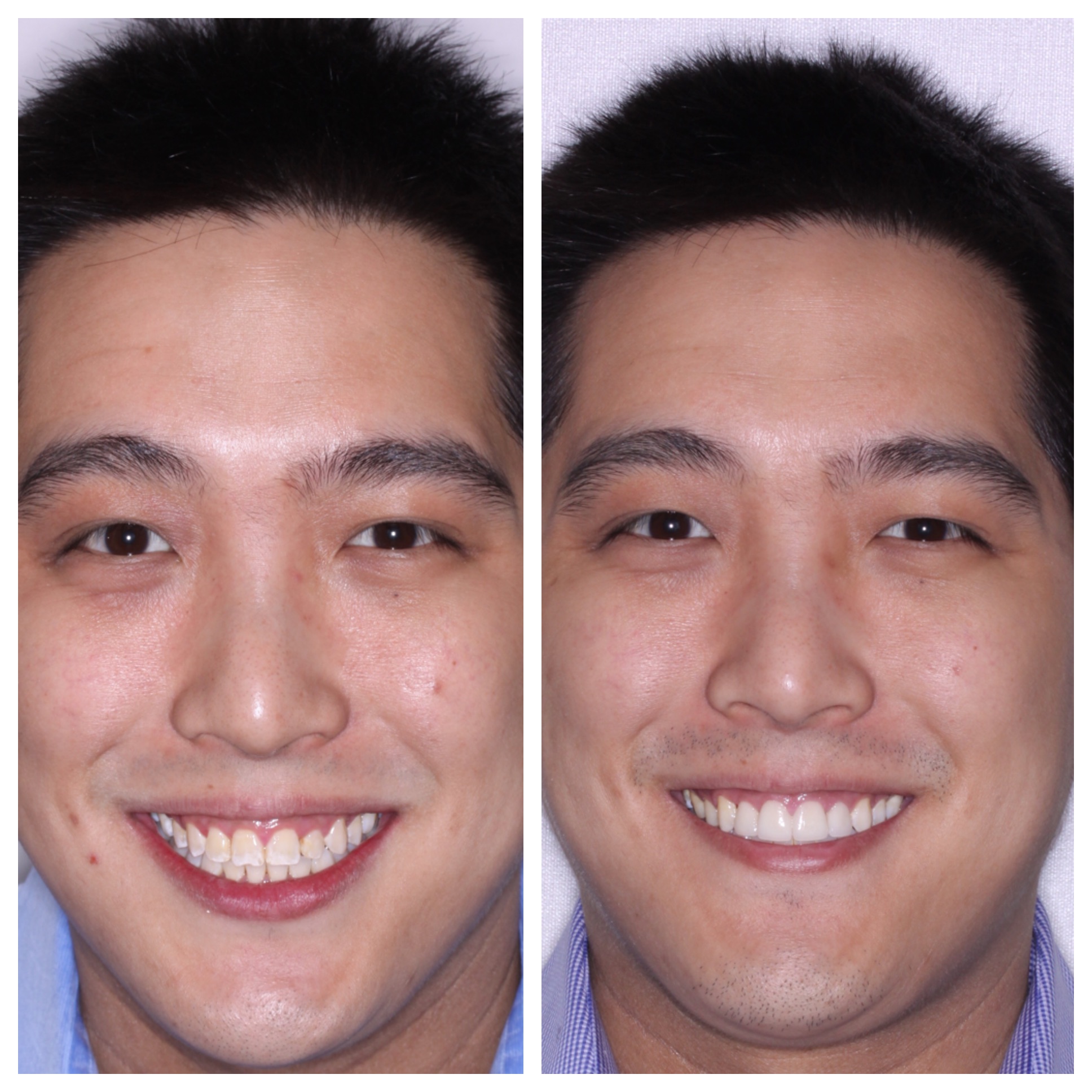 Cosmetic Dentistry NYC Smile Spa Upper East Side
