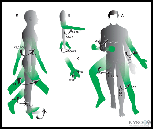 Essentials of Regional Anesthesia Anatomy NYSORA The New