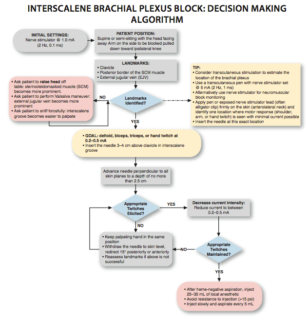Interscalene Brachial Plexus Block NYSORA The New York