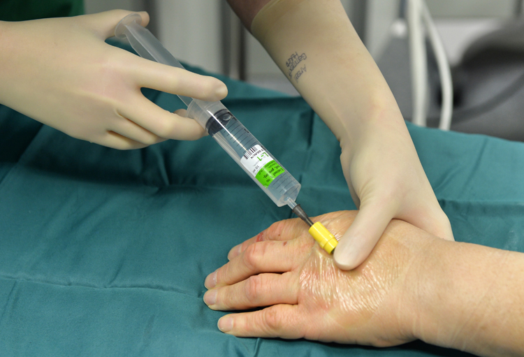 Bier Block NYSORA The New York School of Regional Anesthesia