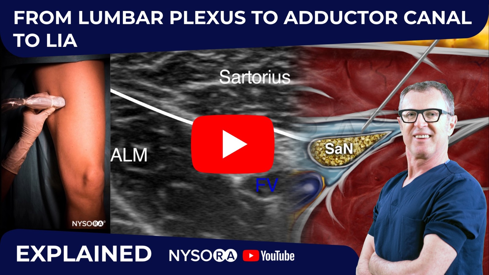 What Is A Nerve Block Procedure Lower Back at Clark Cupp blog